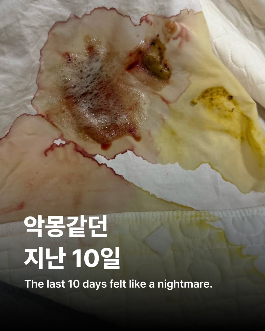 상세 사진 1