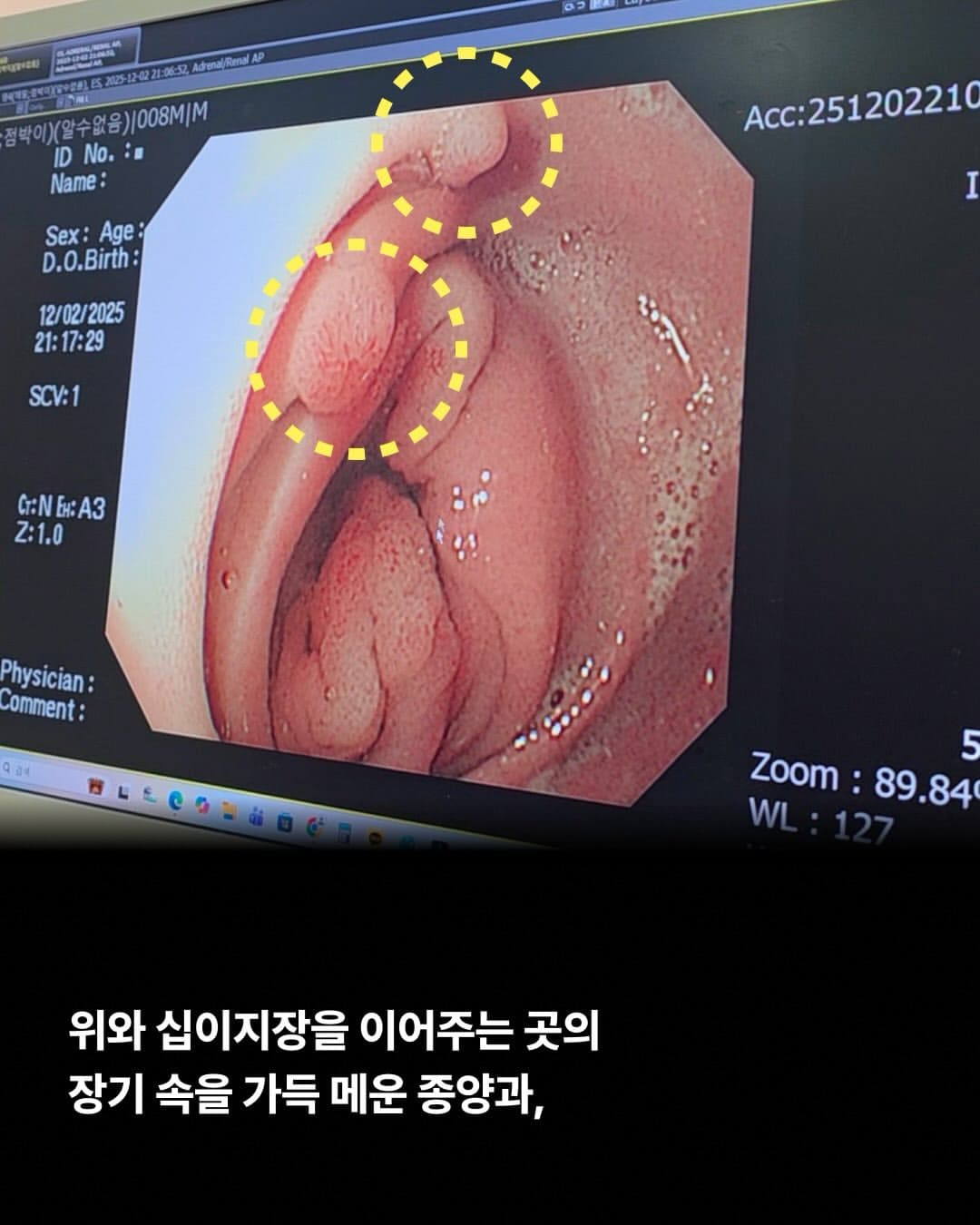 상세 사진 2