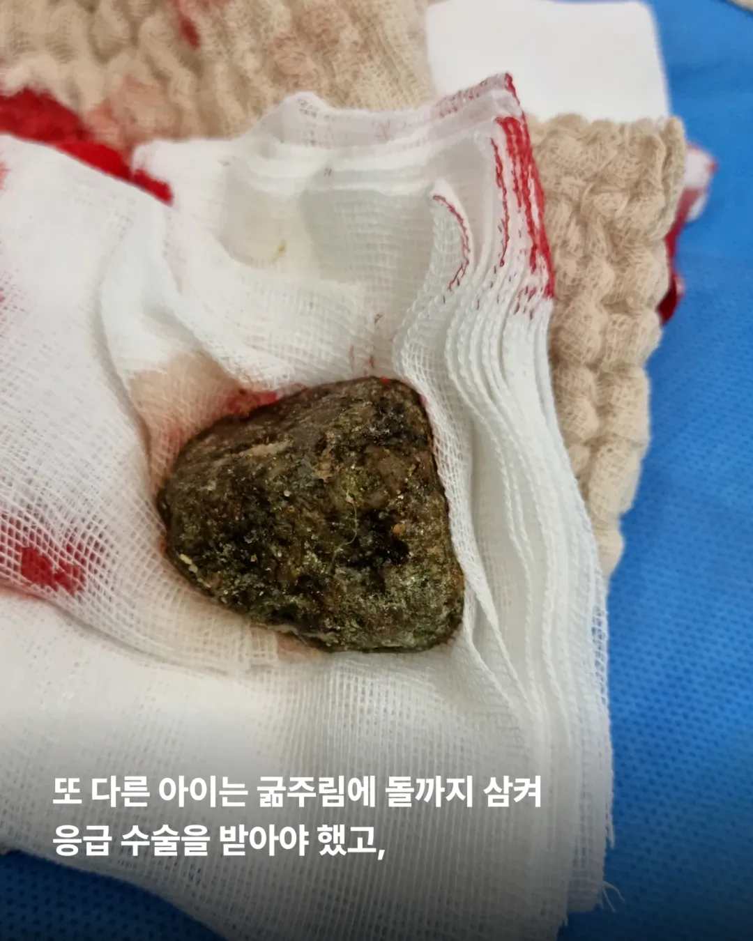 상세 사진 9