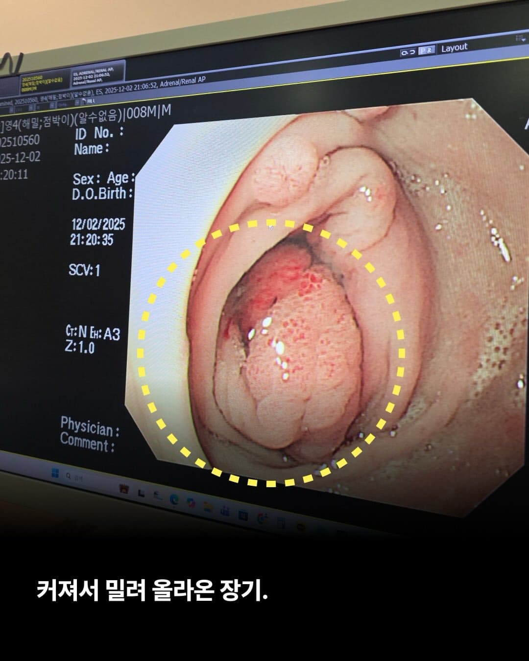 상세 사진 3